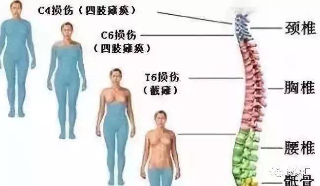 脊髓損傷最新進展,脊髓損傷最新進展研究及治療策略探討